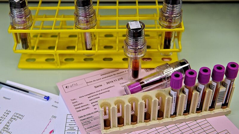 Agência antidoping relata recorde de testes nas Olimpíadas e 5 casos de doping em Paris