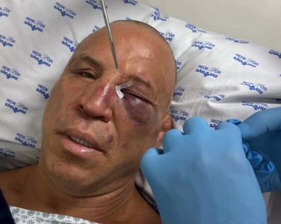 Werdum relembra conversa com Wand no hospital: “Expliquei a ele a situação mais de dez vezes”