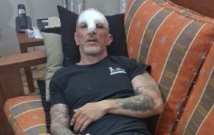 Cristian Cravinhos sofre acidente e fica apavorado de ser preso novamente