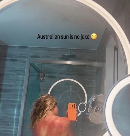 Tenista mexicana expõe queimaduras solares e alerta para risco do calor na Austrália; veja foto