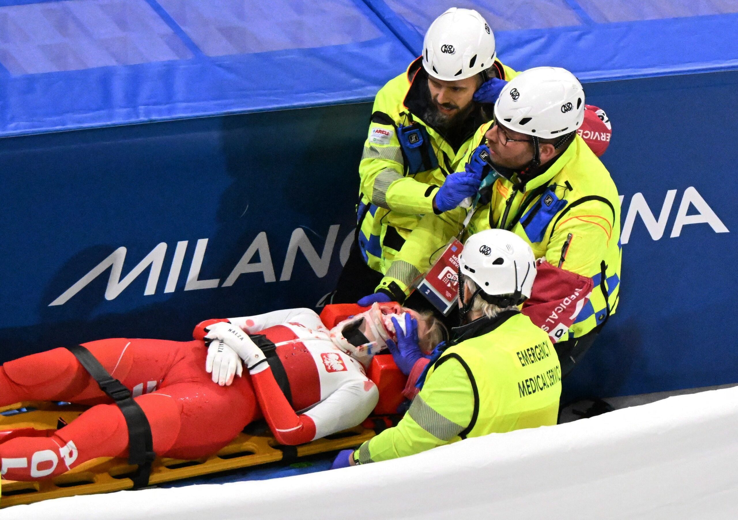 Polonesa atingida por lâmina no rosto atualiza estado de saúde: “Sou mais forte do que penso”