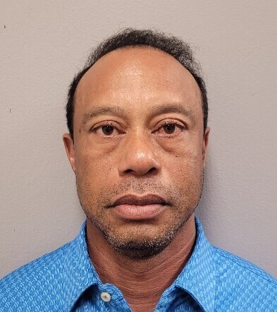 Tiger Woods tinha comprimidos de opioide no bolso ao ser preso após acidente