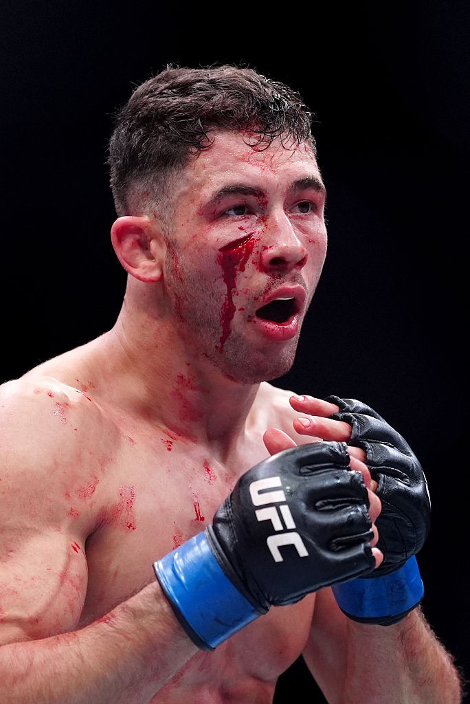 Lutador francês do UFC fica com corte profundo no rosto; imagem é forte