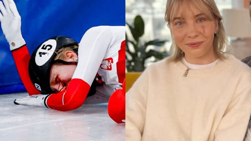 Polonesa atingida por lâmina nos Jogos de Inverno mostra cicatriz no rosto: “Enxergo duplicado”