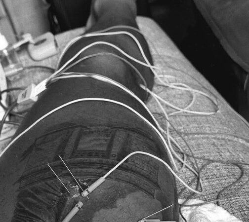 Memphis inicia tratamento de lesão na Holanda e projeta retorno ao Corinthians: “Em breve”