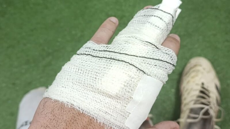 Goleiro Matheus sofre lesão em dedos da mão esquerda e vira desfalque na sequência da Série D
