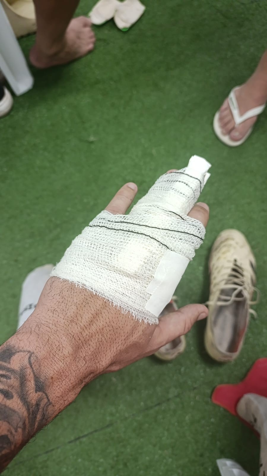 Goleiro Matheus sofre lesão em dedos da mão esquerda e vira desfalque na sequência da Série D