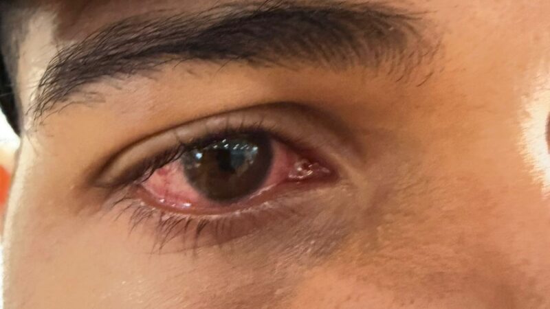 Treinador de Hebert Conceição revela problemas de saúde do lutador dias antes de vitória