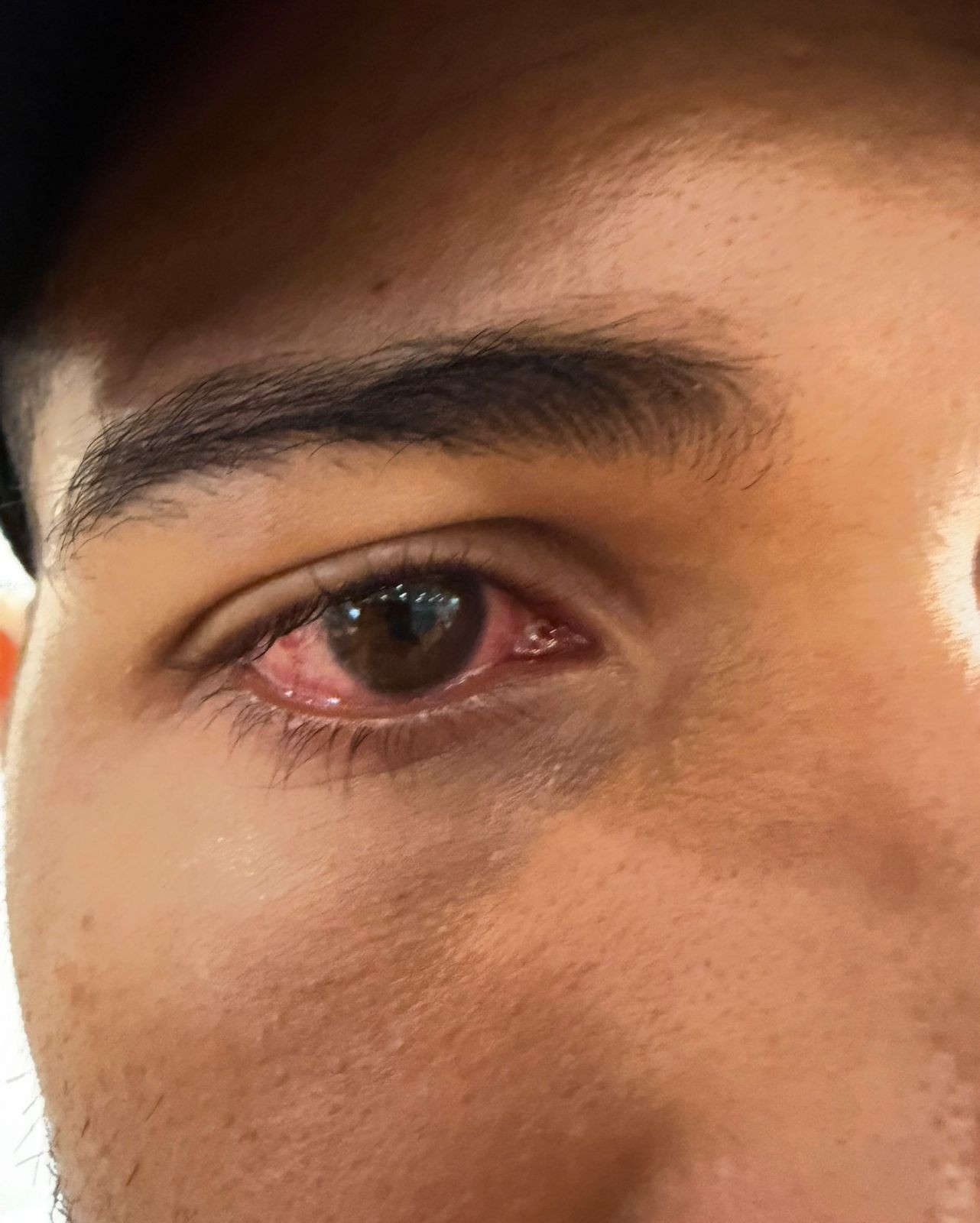 Treinador de Hebert Conceição revela problemas de saúde do lutador dias antes de vitória