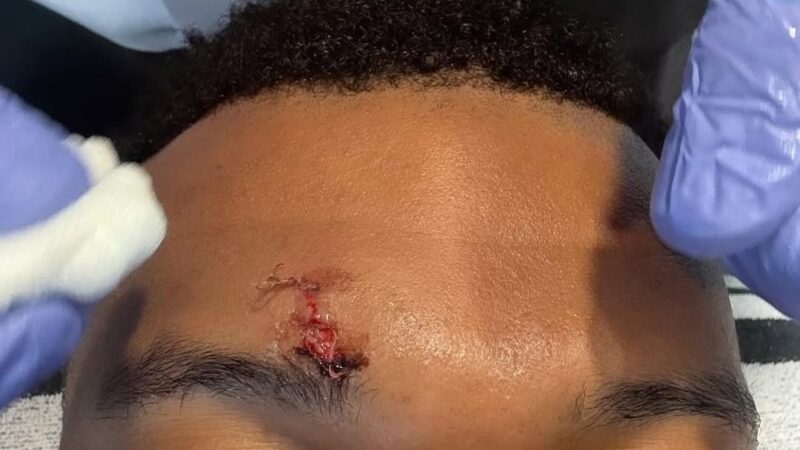 Mbappé toma pontos após levar cotovelada e não treina no Real Madrid às vésperas da Champions