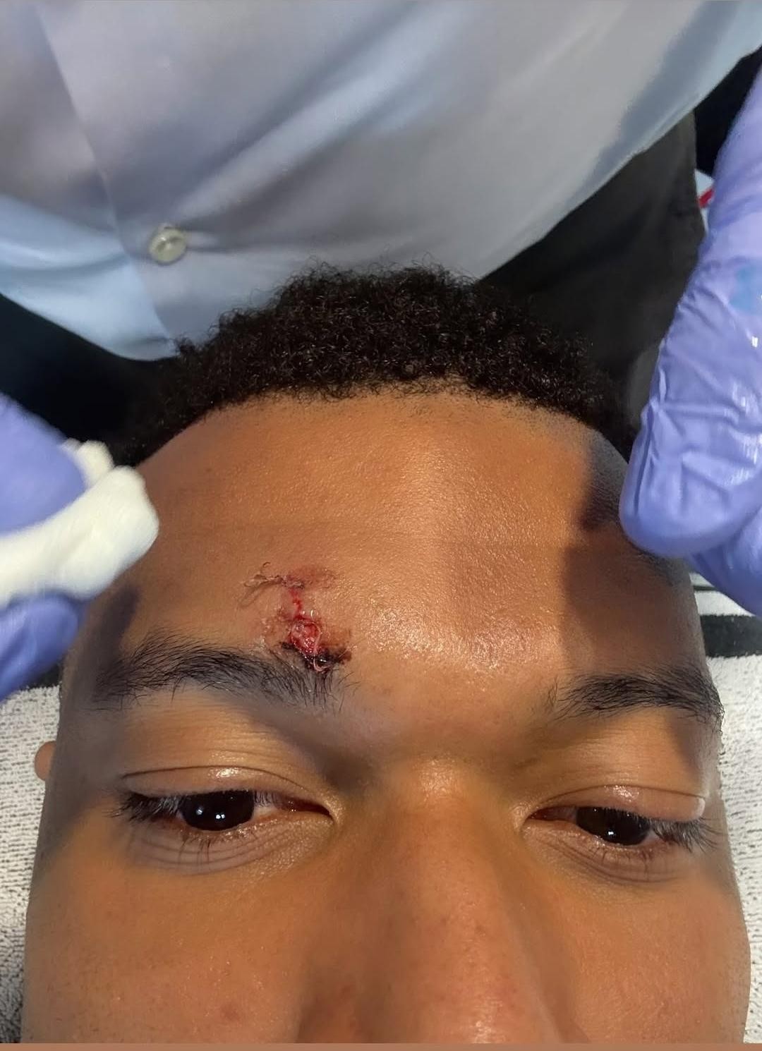 Mbappé toma pontos após levar cotovelada e não treina no Real Madrid às vésperas da Champions