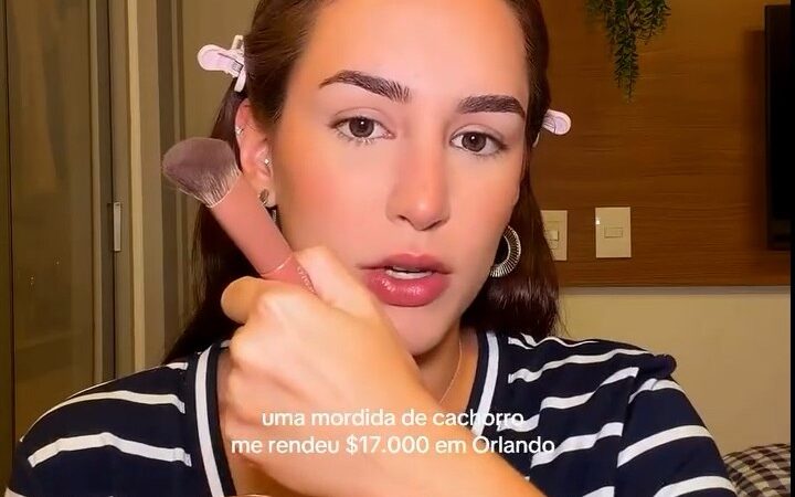 Brasileira paga conta de R$ 84 mil em hospital dos EUA após mordida de cachorro