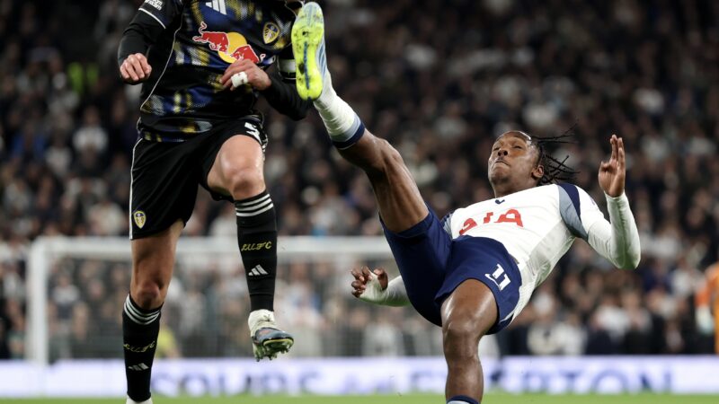 Volante do Leeds mostra ferimento na testa após receber chute de atacante do Tottenham; veja foto