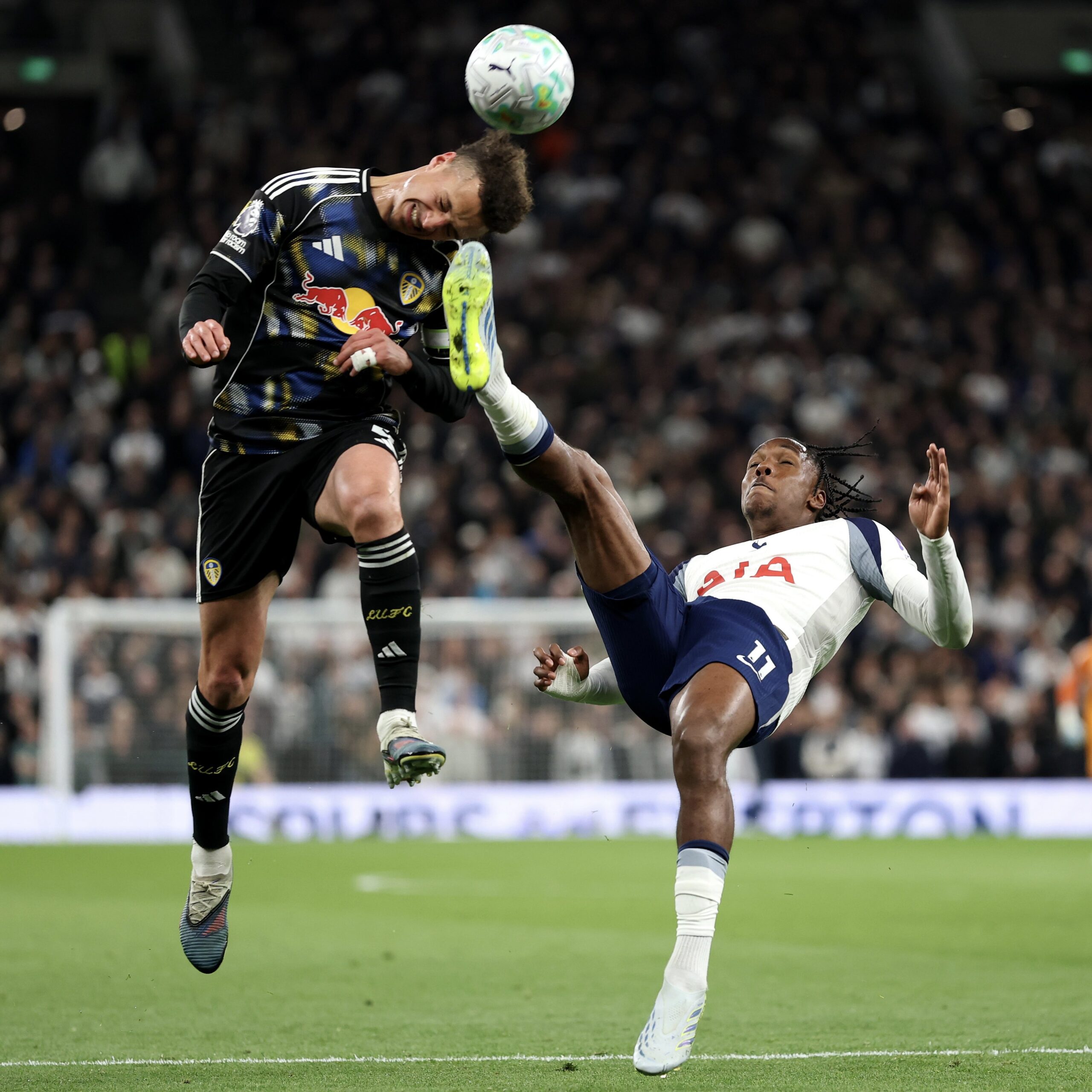 Volante do Leeds mostra ferimento na testa após receber chute de atacante do Tottenham; veja foto