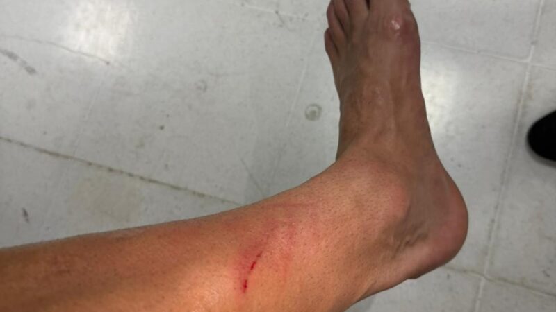 Foto mostra marca na perna de Paquetá após falta dura em Athletico-PR x Flamengo