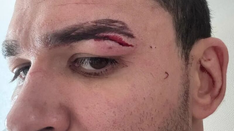 Vídeo: Após nova confusão, Patricky Pitbull é cortado do card do Karate Combat