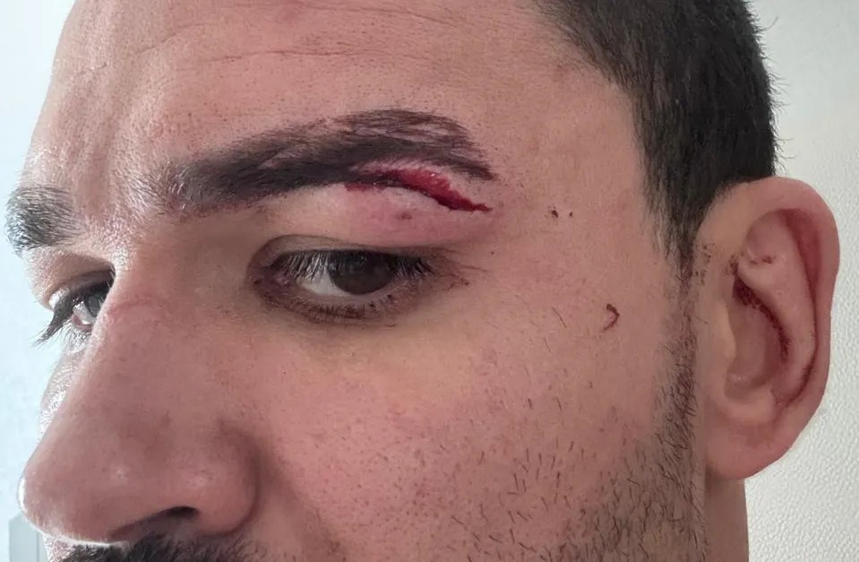 Vídeo: Após nova confusão, Patricky Pitbull é cortado do card do Karate Combat