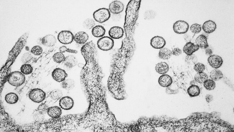Testes de hantavírus deram negativo em pacientes suspeitos na Itália e na Espanha