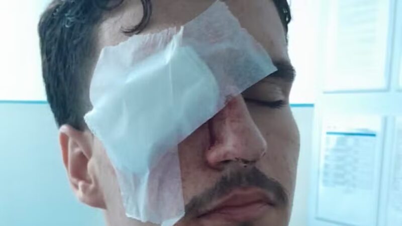 Jovem atingido por bala de borracha no Maracanã perde visão de um olho e fará cirurgia; mãe critica ação policial