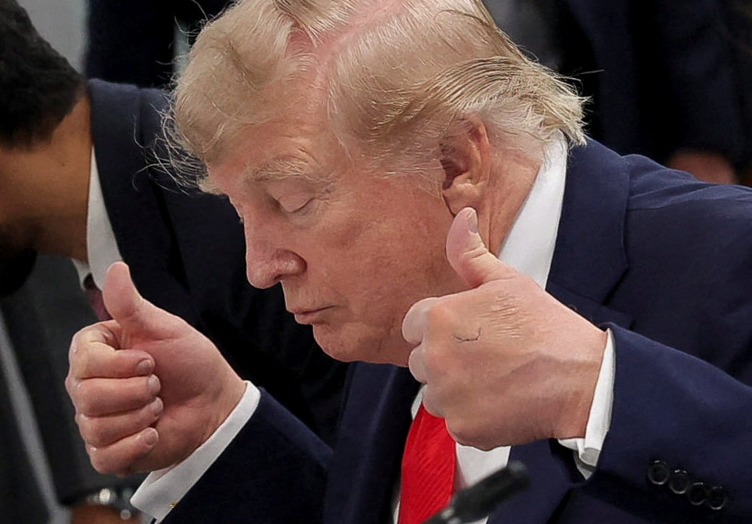 Em meio à cúpula do G7, Donald Trump volta a aparecer com marcas na mão