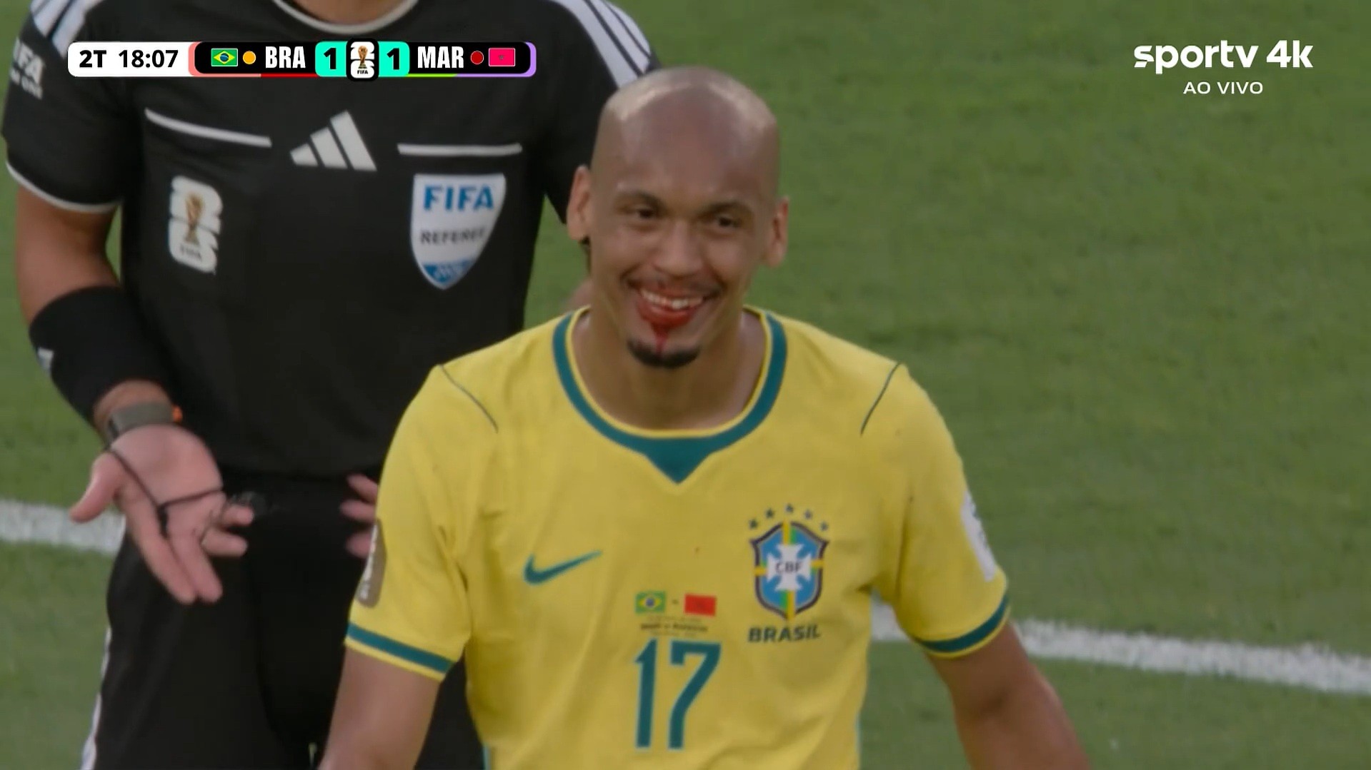 Fabinho fica com o nariz ensanguentado em Brasil x Marrocos; veja vídeo