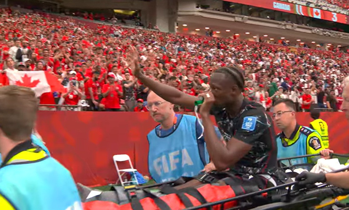 Técnico do Canadá comenta lesão de Koné: “Escutamos o osso quebrar”