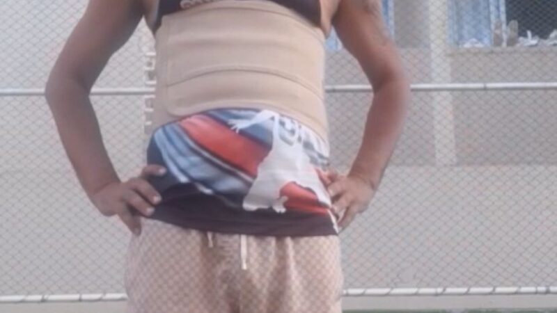 Ex-meia pede ajuda após acidente com barra de 250 kg: “Estou há 25 dias sem defecar”
