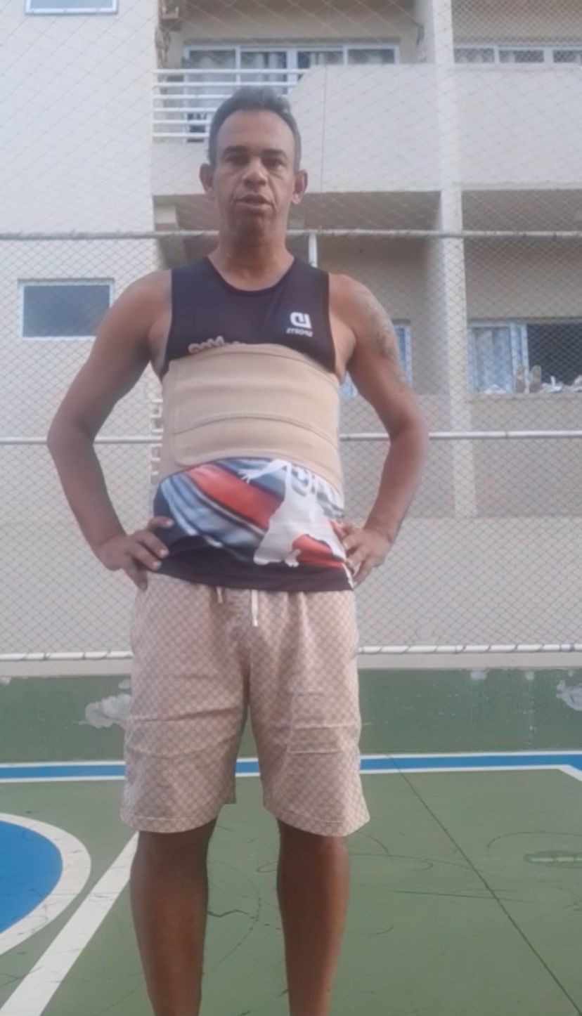 Ex-meia pede ajuda após acidente com barra de 250 kg: “Estou há 25 dias sem defecar”