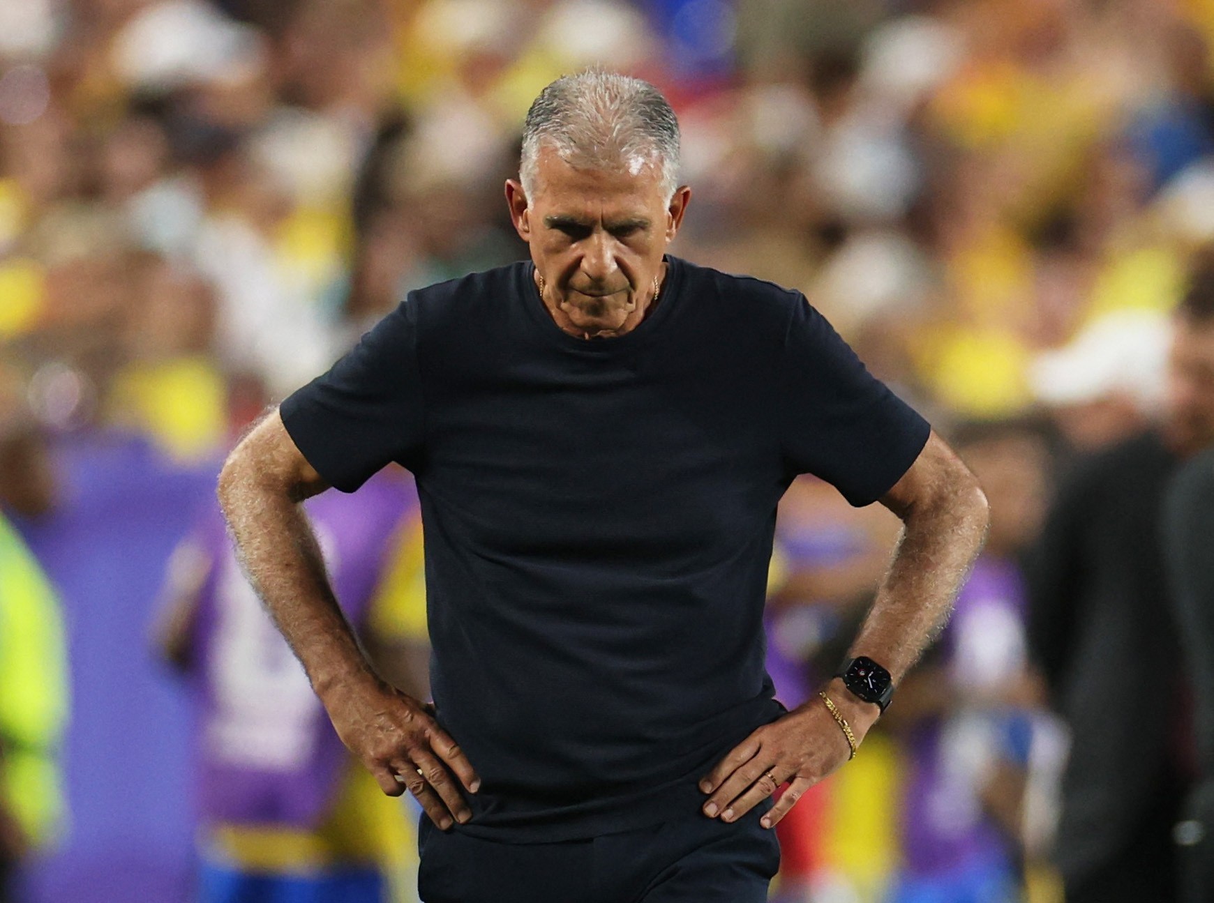 Técnico de Gana reconhece superioridade da Colômbia em eliminação: “O melhor time venceu”