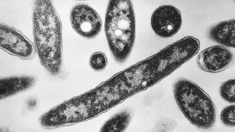 O que é a doença dos legionários, infecção que já matou duas pessoas e infectou mais de 70 em surto em Nova York