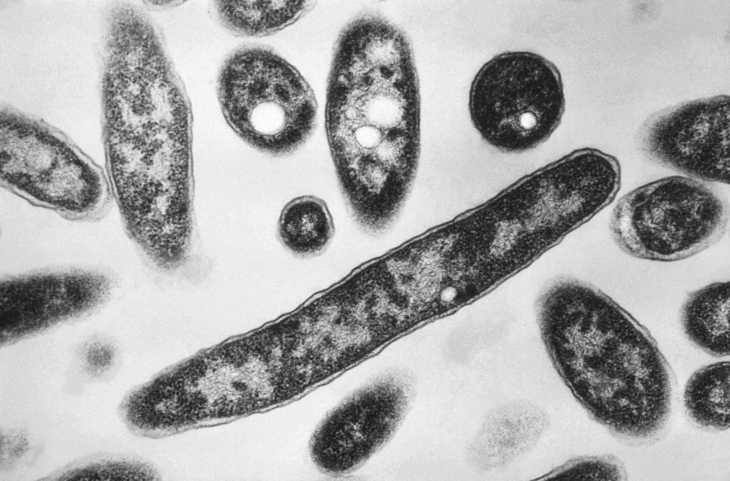 O que é a doença dos legionários, infecção que já matou duas pessoas e infectou mais de 70 em surto em Nova York