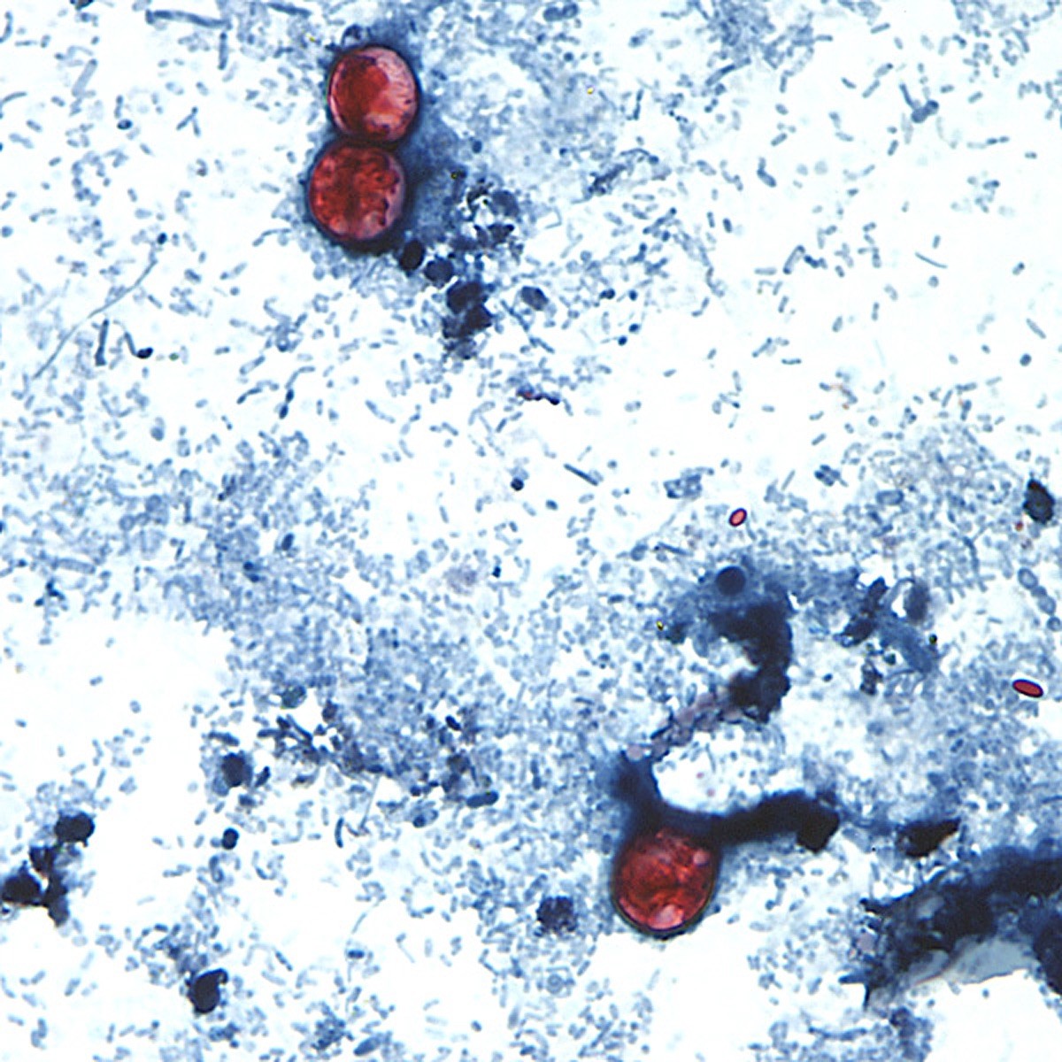 Parasita que provoca ‘diarreia explosiva’ infecta mais de 2,8 mil pessoas nos EUA; investigação aponta alface como suspeita