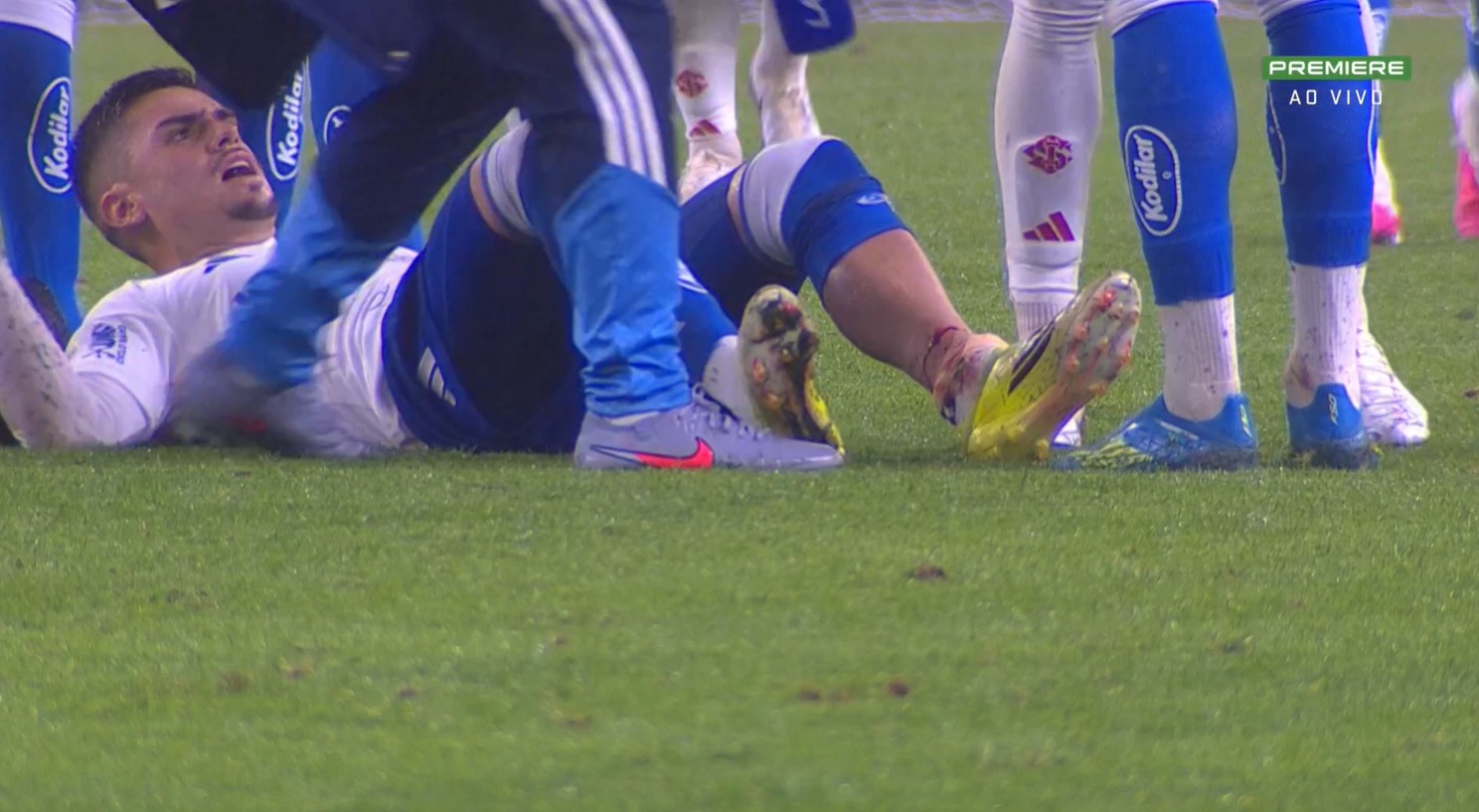 Atacante do Cruzeiro, Gabriel Pec se pronuncia após lesão grave na perna esquerda