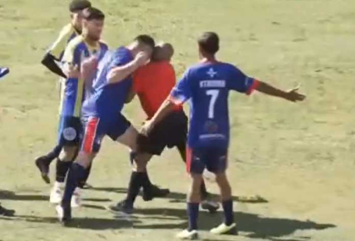 Árbitro toma cabeçada em jogo da várzea em SP e terá que fazer cirurgia; veja o vídeo