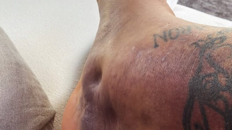 Zagueiro do Uruguai posta fotos de tornozelo inchado após fracasso da seleção na Copa do Mundo