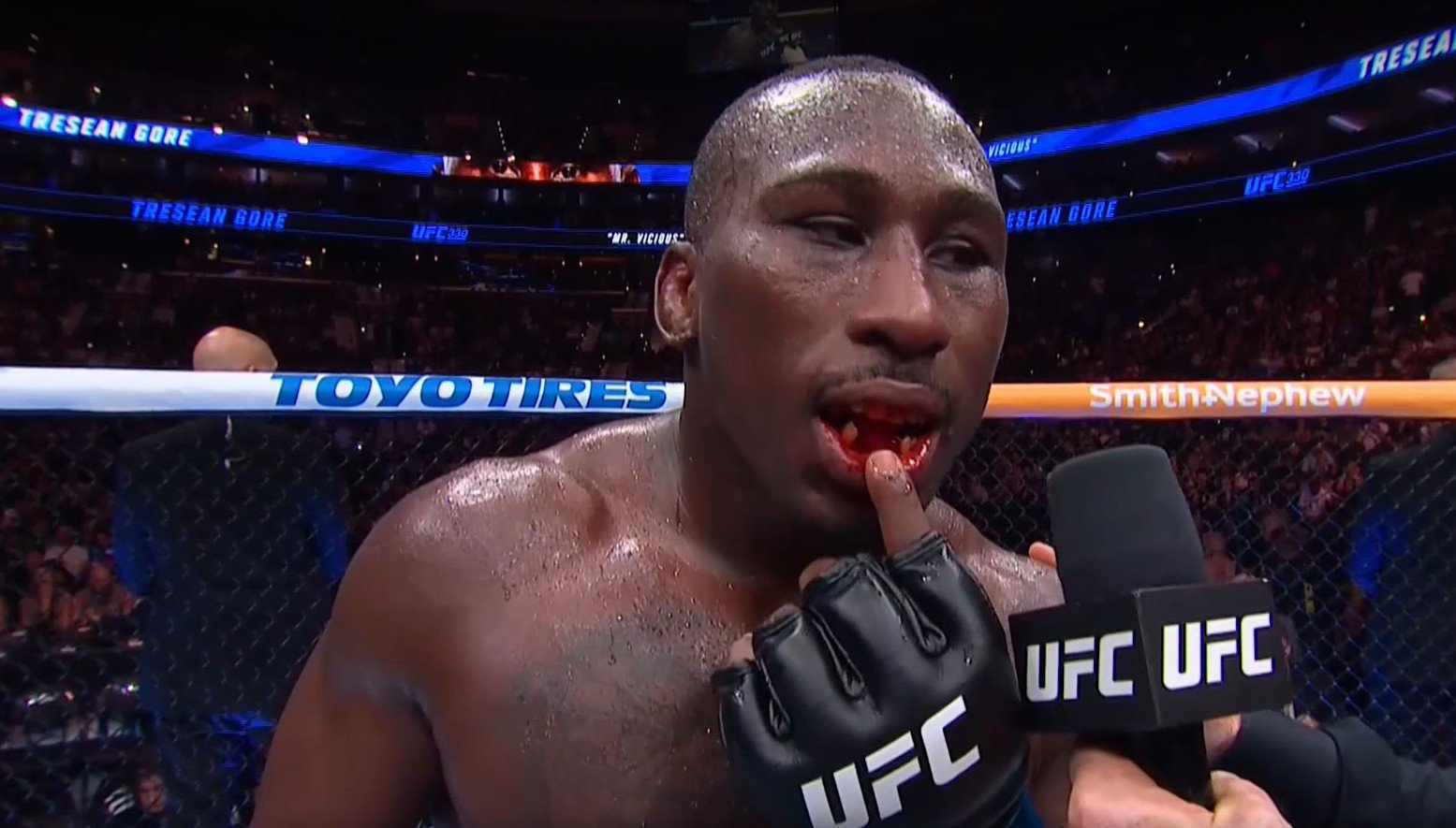 UFC 330: Tresean Gore vence Vicente Luque, mas perde dentes na luta e fica “banguela”