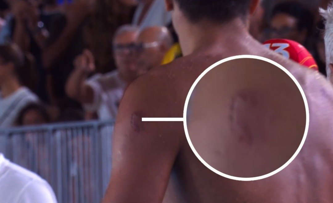 Jogo com acusação de mordida termina em confusão no polo aquático; veja vídeo