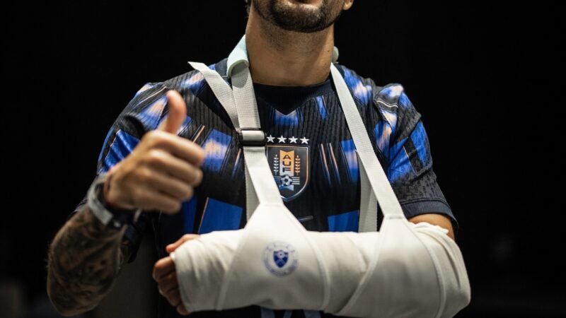 Seleção do Uruguai publica foto de Arrascaeta, do Flamengo, com braço imobilizado