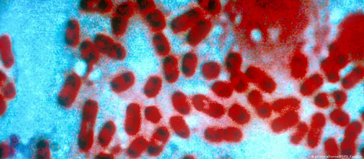 Rússia descarta risco de epidemia após morte de funcionária de laboratório por peste
